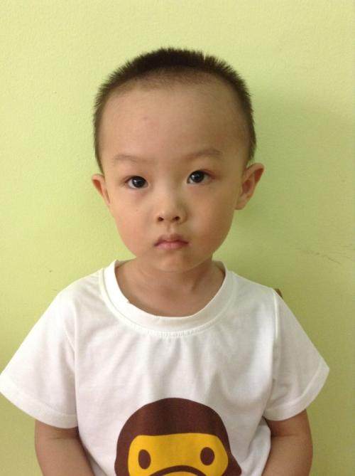 父母脸上有斑孩子怎么预防,父母都有青春痘孩子如何预防