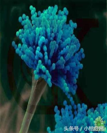 ivd基础知识大全,真菌检测要点