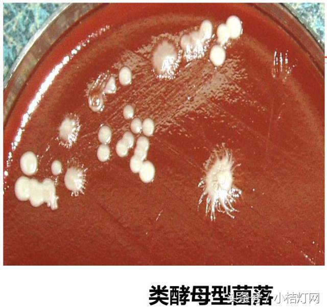 真菌微生物国标检测方法,微生物真菌检验