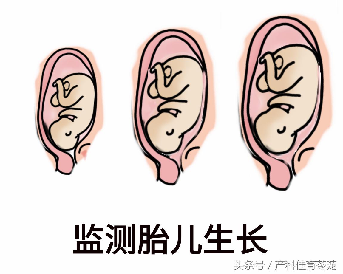 孕期肥胖的原因及解决方法,孕期看看自己胖成什么样了