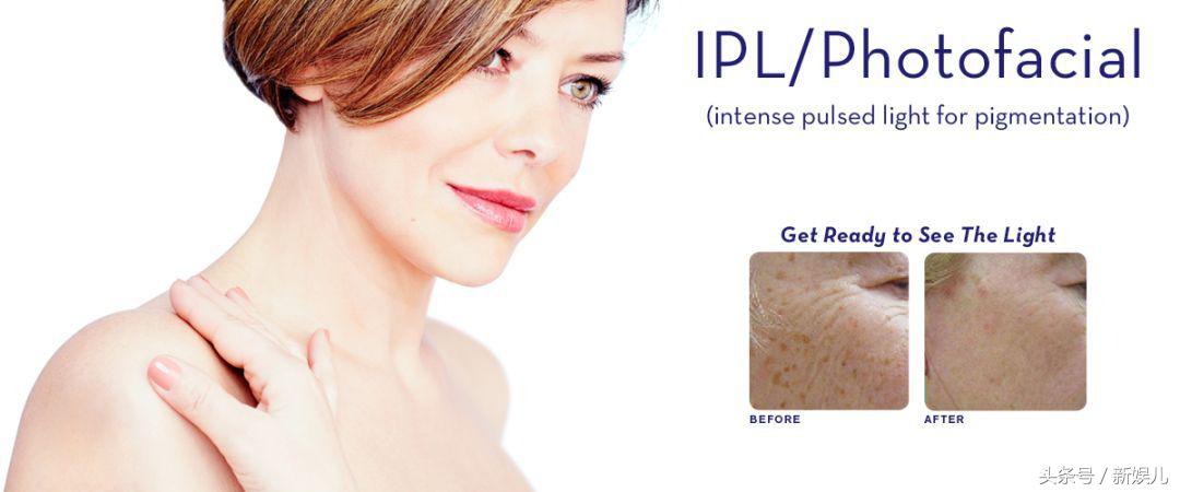 为什么范冰冰比林允气质好,范冰冰王菲谁漂亮