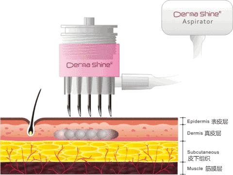 为什么范冰冰比林允气质好,范冰冰王菲谁漂亮