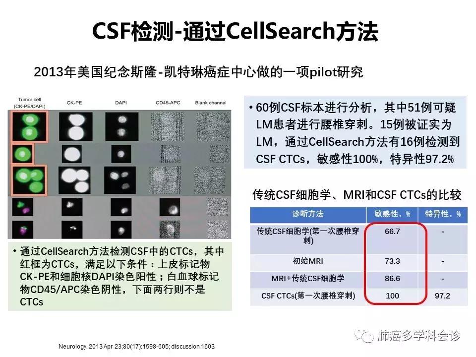 【宣晟医疗】肺癌脑膜转移的诊断方法及研究进展