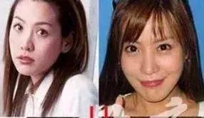 韩国明星整容整完开挂般的人生,整容整毁的韩国女星