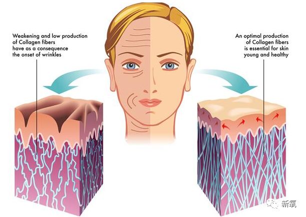 孙怡涂粉,孙怡裹腿美白大法