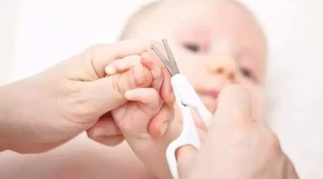 宝宝趾甲总是往肉里长，越剪越严重怎么办！