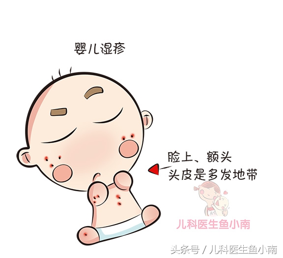 宝宝湿疹和热疹的正确护理方法,宝宝湿疹不同问题不同治疗方法