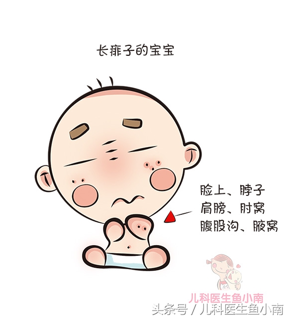 宝宝湿疹和热疹的正确护理方法,宝宝湿疹不同问题不同治疗方法