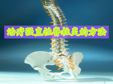 哪些方法可以治疗强直性脊柱炎