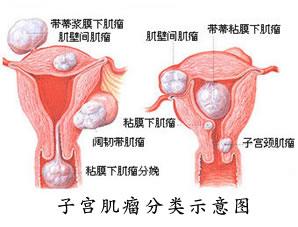 48岁月经紊乱出血不止,月经不止上曼月环继续出血怎么办