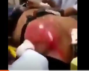 男子一天喝了24罐红牛的下场,男子喝5瓶红牛后惊人的一幕