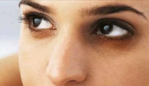 脸上能看出是妇科病吗,姐妹们脸上有各种肌肤问题