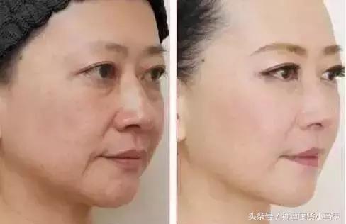 深度剖析医美整形的危害,医美整形该如何避坑呢