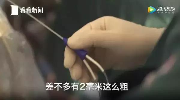 女大学生捐卵案完整,女大学生捐29个卵