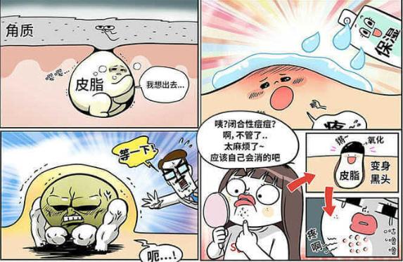 去黑头草莓鼻最有效的方法,怎么去黑头不会变草莓鼻