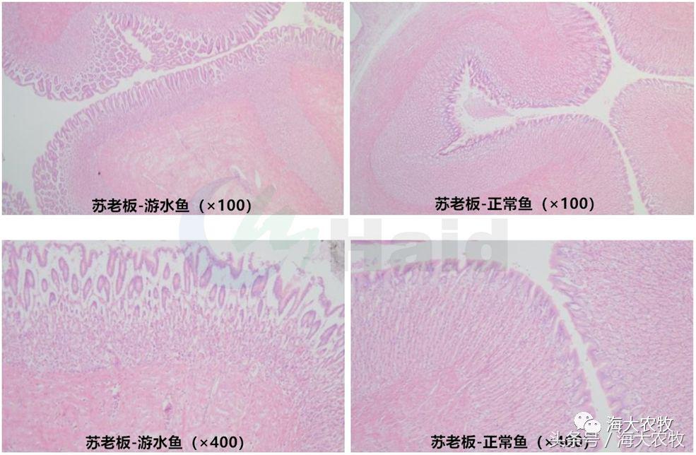 显微镜效果,显微镜对医学检验的推动作用