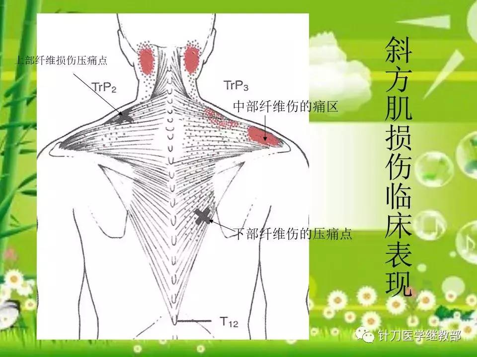 颈椎肌肉损伤用小针刀治疗,针刀治疗颈椎导致神经损伤