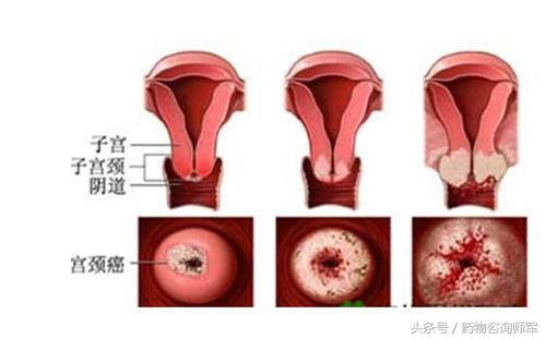 女性不可不知的6大妇科常规检查