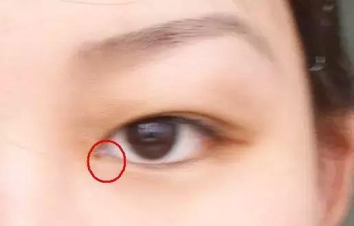 早上起床眼屎多，你知道不同的眼屎说明什么问题吗？