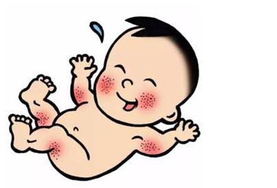 小儿湿疹怎么快速消退,小儿湿疹怎么护理有效