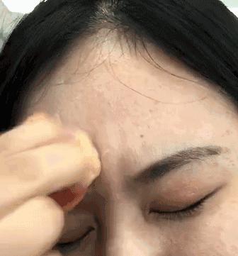 怎样消除痘印食疗,青春期痘印怎么消除小妙招