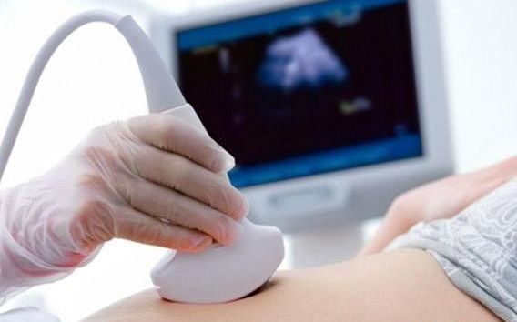 怎么判断胎儿缺氧还是正常胎动,怎么判断胎儿是胎动频繁还是缺氧