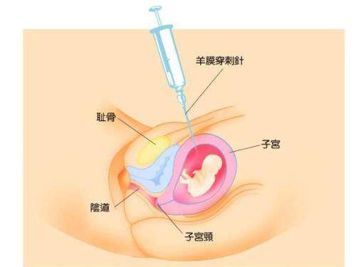 连载故事之七：没有心管搏动，一定是机器的问题！