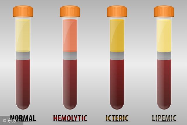 胆红素也是转氨酶吗,胆红素跟肝有关吗
