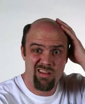 脱发的原因找到了,脱发的原因有哪些预防方法是什么