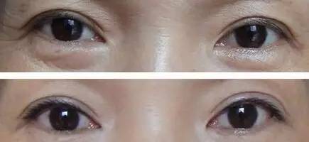 一款每天都好用的眼膜推荐,可以敷一整晚的眼膜测评