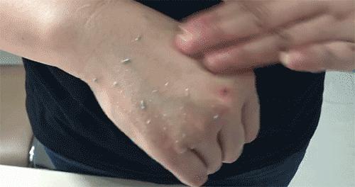 轻轻抹一抹皮肤越来越好,轻轻擦到皮肤就留下黑印子