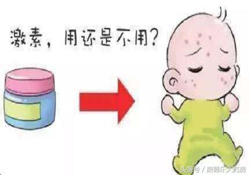 宝宝湿疹能涂激素药膏吗