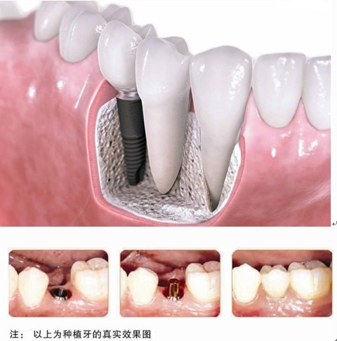 一问一答口腔科普视频,一问一答正畸