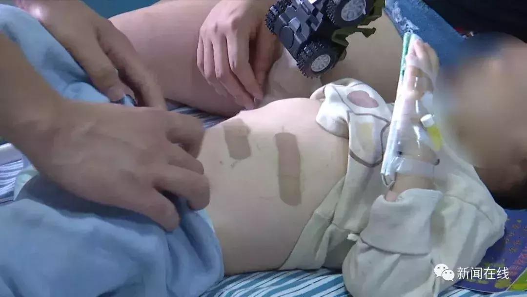 惊！广西2岁半幼儿胃穿孔，竟然是因为这种不良习惯！