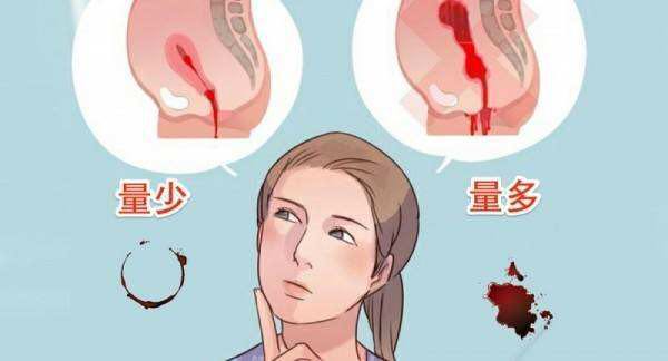 卵巢早衰女性最大的克星,45女人卵巢早衰还需要调理吗