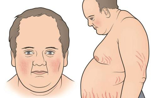 忽然变胖的原因有哪些？可能是生病了，也可能是好事在发生