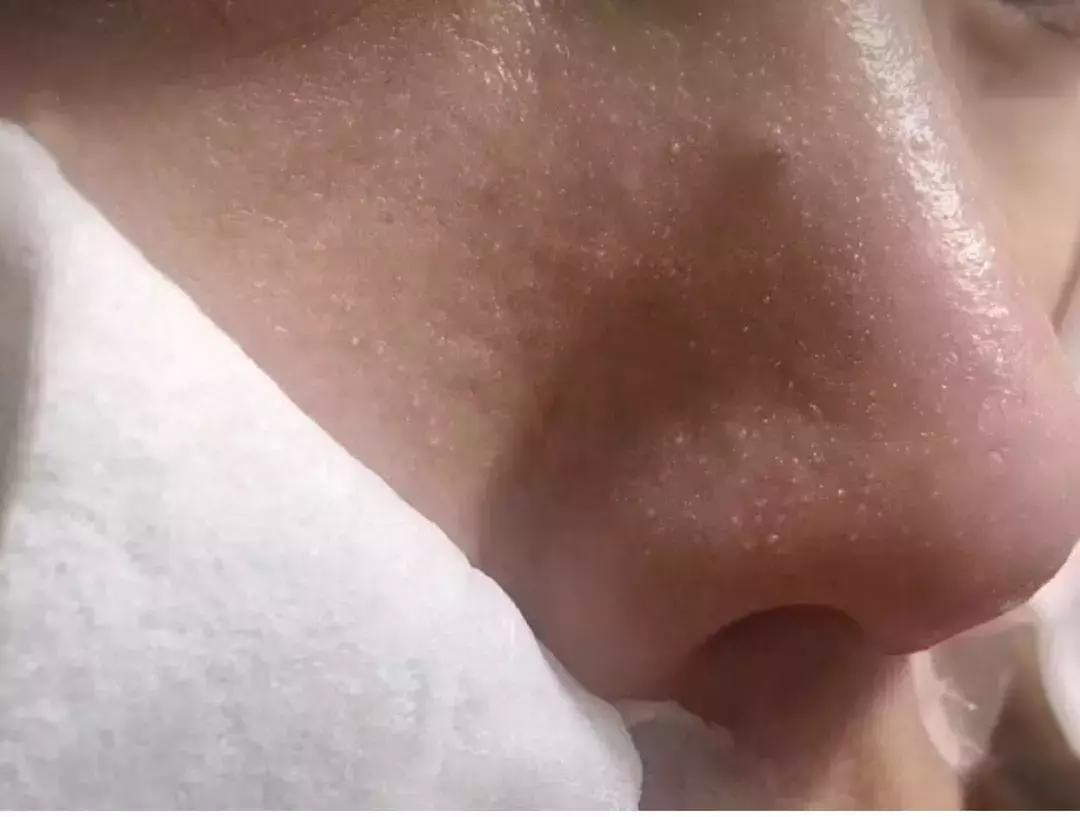 杩欎釜澶忓涓嶈鏌撶殑鍙戣壊,涓嶈绮楁瘺瀛旇刀璧拌崏鑾撻蓟