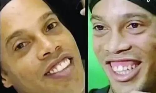 原来，上牙盖住下牙太多，也对牙齿有伤害！该怎么矫正？