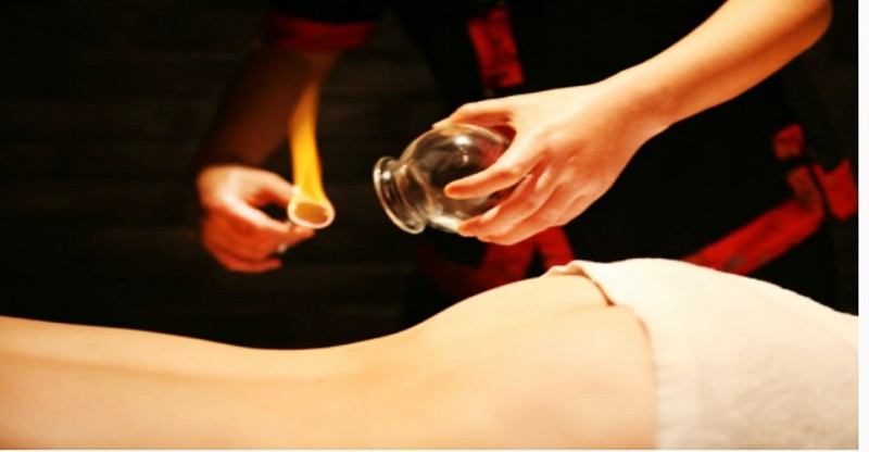 拔罐后罐印代表什么配图,拔罐时出现罐印红是怎么回事