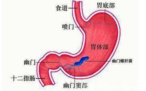 孩子有口臭一般是什么原因,导致口臭的两大元凶究竟是什么呢
