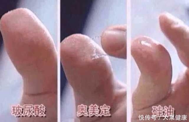 如何识别玻尿酸真假鉴别,玻尿酸的真假辨别方法