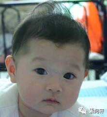 像蚯蚓一样的凸起的纹,像蚯蚓一样黑色的是什么