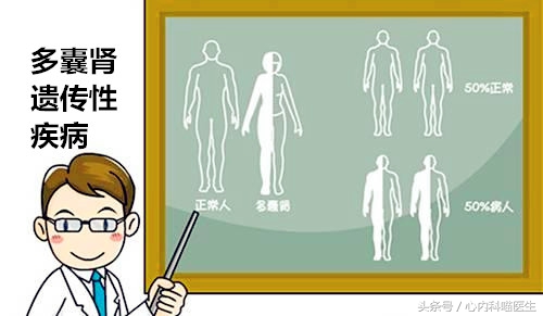 “肾囊肿”与“多囊肾”有啥区别？会造成高血压吗？需要治疗吗？