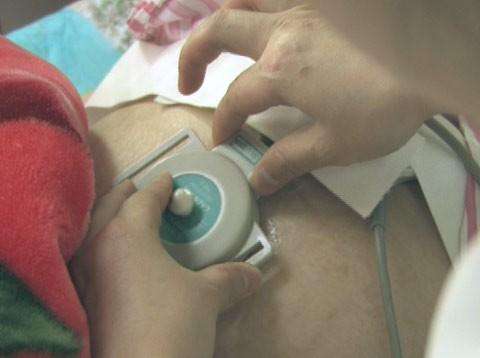 胎心监护的意义和应对方法,胎心监护解读