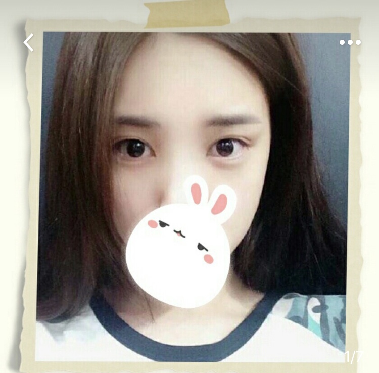 佳丽护肤记——从满脸痘痘到美到没有朋友的祛痘历程