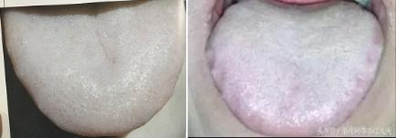 吃饭不消化肚子胀怎么回事,肚子胀不饿怎么治疗