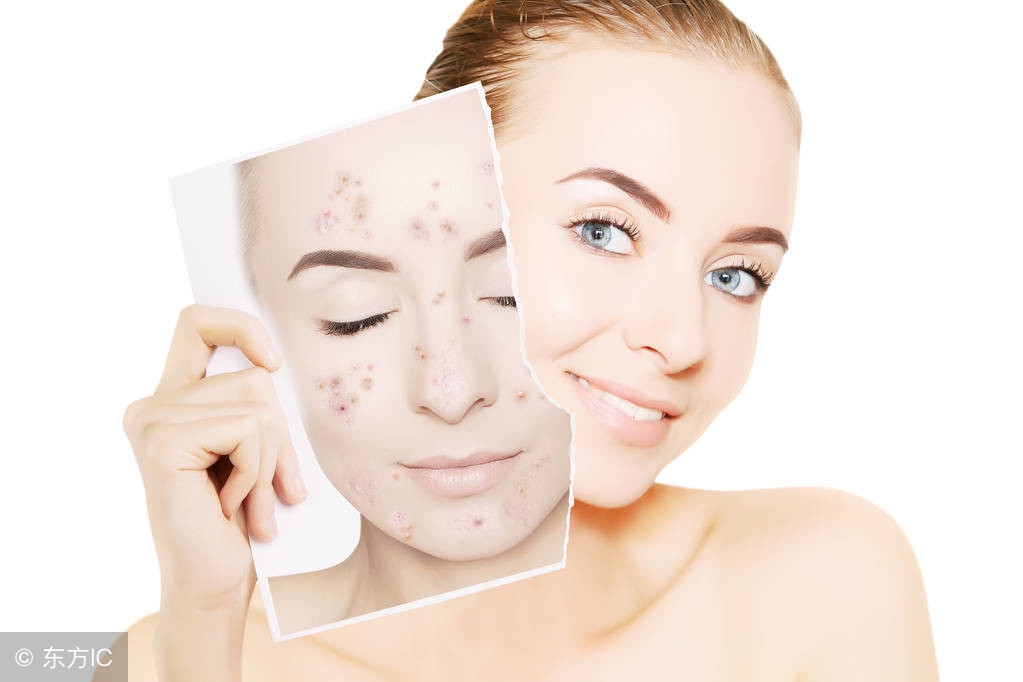 怎样才能消除痘,怎样才能彻底消除痘