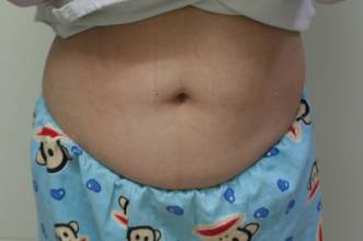 预防生完孩子后的肚子皱皱巴巴,生宝宝后怎么修复大肚腩