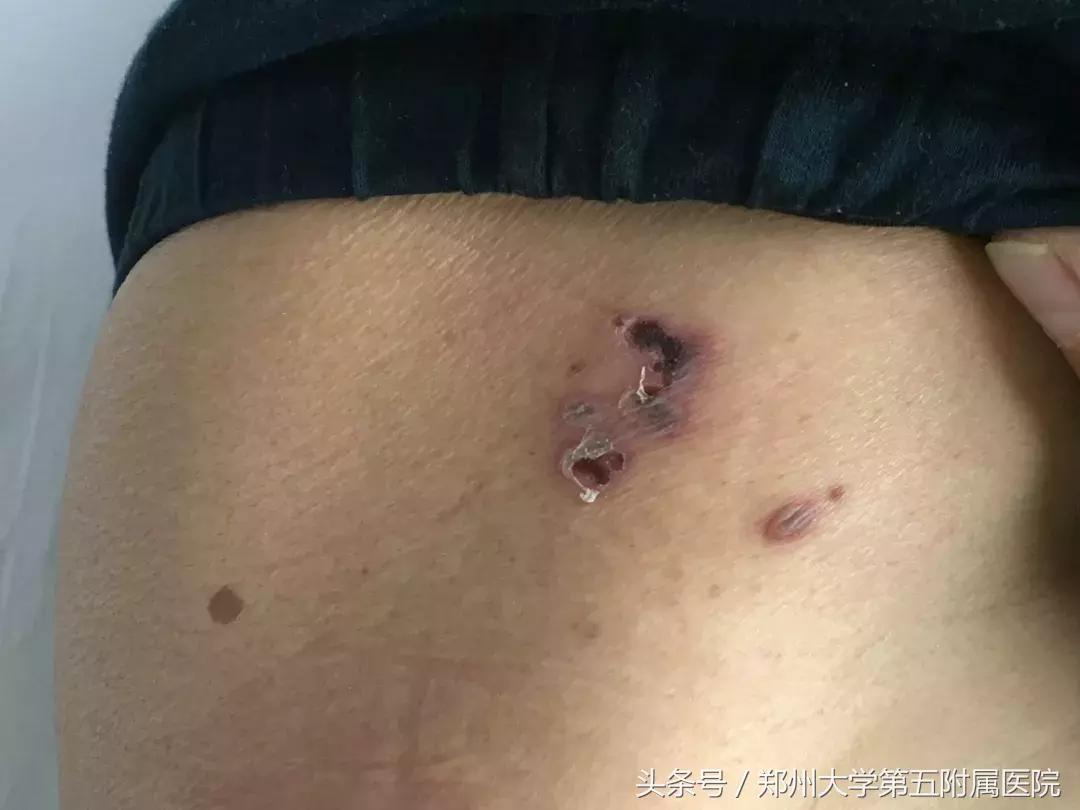 难忍的疼痛感,难忍的剧痛