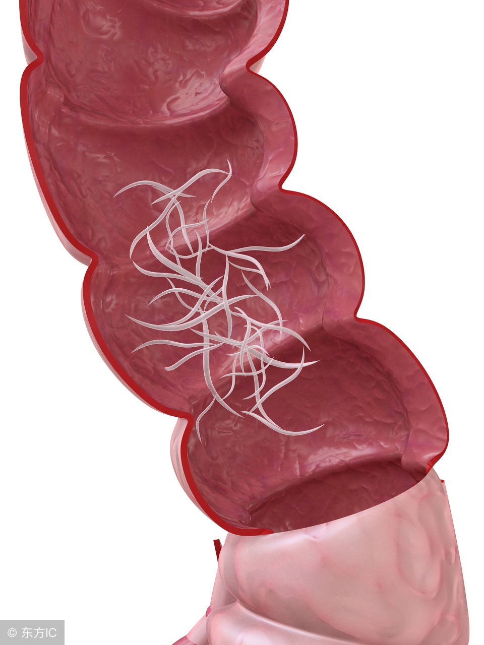 小女孩隐*处私**掉虫子?这个问题不少见